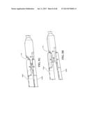 METHODS, INSTRUMENTS AND DEVICES FOR EXTRAGASTIC REDUCTION OF STOMACH     VOLUME diagram and image