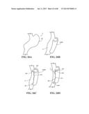 METHODS, INSTRUMENTS AND DEVICES FOR EXTRAGASTIC REDUCTION OF STOMACH     VOLUME diagram and image