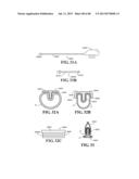 METHODS, INSTRUMENTS AND DEVICES FOR EXTRAGASTIC REDUCTION OF STOMACH     VOLUME diagram and image