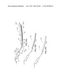 METHODS, INSTRUMENTS AND DEVICES FOR EXTRAGASTIC REDUCTION OF STOMACH     VOLUME diagram and image