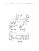 METHODS, INSTRUMENTS AND DEVICES FOR EXTRAGASTIC REDUCTION OF STOMACH     VOLUME diagram and image