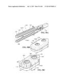 METHODS, INSTRUMENTS AND DEVICES FOR EXTRAGASTIC REDUCTION OF STOMACH     VOLUME diagram and image