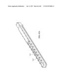 METHODS, INSTRUMENTS AND DEVICES FOR EXTRAGASTIC REDUCTION OF STOMACH     VOLUME diagram and image