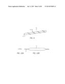 MINIMALLY INVASIVE TISSUE SUPPORT diagram and image