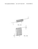 MINIMALLY INVASIVE TISSUE SUPPORT diagram and image