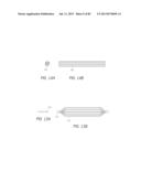 MINIMALLY INVASIVE TISSUE SUPPORT diagram and image