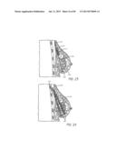 MINIMALLY INVASIVE TISSUE SUPPORT diagram and image