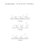 MINIMALLY INVASIVE TISSUE SUPPORT diagram and image