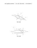 MINIMALLY INVASIVE TISSUE SUPPORT diagram and image