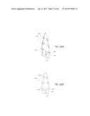 MINIMALLY INVASIVE TISSUE SUPPORT diagram and image