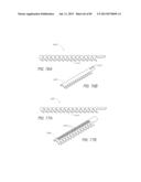 MINIMALLY INVASIVE TISSUE SUPPORT diagram and image