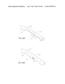 MINIMALLY INVASIVE TISSUE SUPPORT diagram and image