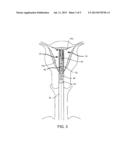 System and Method for Tissue Ablation in a Body Cavity diagram and image