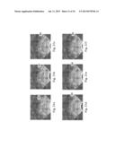 Devices, Systems, and Methods for Controlling Field of View in Imaging     Systems diagram and image