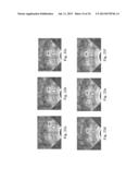 Devices, Systems, and Methods for Controlling Field of View in Imaging     Systems diagram and image