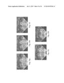 Devices, Systems, and Methods for Controlling Field of View in Imaging     Systems diagram and image