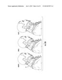 CERVICAL COLLAR WITH CABLE REEL ADJUSTMENT SYSTEM diagram and image