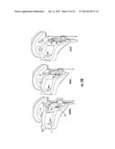 CERVICAL COLLAR WITH CABLE REEL ADJUSTMENT SYSTEM diagram and image