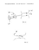 METHODS AND DEVICES FOR INTRA-ATRIAL SHUNTS HAVING ADJUSTABLE SIZES diagram and image