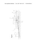 INFUSION SITE INTERFACES AND INSERTION DEVICES FOR INFUSION SITE     INTERFACES diagram and image