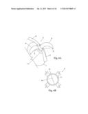 DEVICES AND METHODS FOR MINIMALLY-INVASIVE SURGICAL PROCEDURES diagram and image