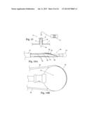 DEVICES AND METHODS FOR MINIMALLY-INVASIVE SURGICAL PROCEDURES diagram and image