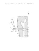 SOFT TISSUE PROTECTOR AND DRILL GUIDE FOR AN IMPLANTATION KIT diagram and image