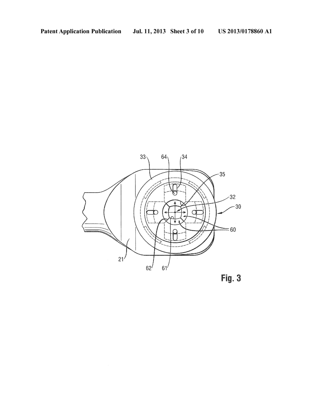 SOFT TISSUE PROTECTOR AND DRILL GUIDE FOR AN IMPLANTATION KIT - diagram, schematic, and image 04