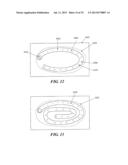 Methods and Devices for Applying Closed Incision Negative Pressure Wound     Therapy diagram and image