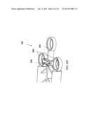 Methods and Devices for Applying Closed Incision Negative Pressure Wound     Therapy diagram and image