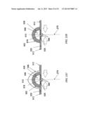 Methods and Devices for Applying Closed Incision Negative Pressure Wound     Therapy diagram and image