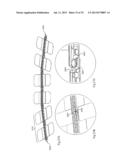 Methods and Devices for Applying Closed Incision Negative Pressure Wound     Therapy diagram and image