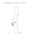 Methods and Devices for Applying Closed Incision Negative Pressure Wound     Therapy diagram and image