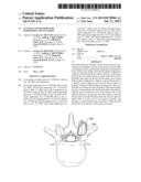 SYSTEMS AND METHODS FOR PERFORMING SPINAL FUSION diagram and image