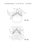 SYSTEMS AND METHODS FOR PERFORMING SPINAL FUSION diagram and image