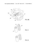 SYSTEMS AND METHODS FOR PERFORMING SPINAL FUSION diagram and image