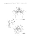 SYSTEMS AND METHODS FOR PERFORMING SPINAL FUSION diagram and image