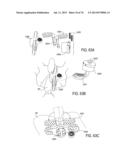 SYSTEMS AND METHODS FOR PERFORMING SPINAL FUSION diagram and image