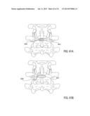 SYSTEMS AND METHODS FOR PERFORMING SPINAL FUSION diagram and image