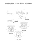 SYSTEMS AND METHODS FOR PERFORMING SPINAL FUSION diagram and image