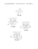 SYSTEMS AND METHODS FOR PERFORMING SPINAL FUSION diagram and image