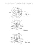 SYSTEMS AND METHODS FOR PERFORMING SPINAL FUSION diagram and image