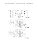 SYSTEMS AND METHODS FOR PERFORMING SPINAL FUSION diagram and image