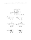 SYSTEMS AND METHODS FOR PERFORMING SPINAL FUSION diagram and image