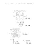 SYSTEMS AND METHODS FOR PERFORMING SPINAL FUSION diagram and image