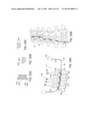 SYSTEMS AND METHODS FOR PERFORMING SPINAL FUSION diagram and image