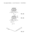 SYSTEMS AND METHODS FOR PERFORMING SPINAL FUSION diagram and image