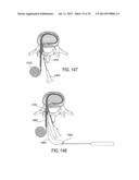 SYSTEMS AND METHODS FOR PERFORMING SPINAL FUSION diagram and image