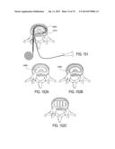 SYSTEMS AND METHODS FOR PERFORMING SPINAL FUSION diagram and image