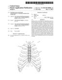 METHOD AND SYSTEM FOR LONGITUDINAL CLOSURE OF DISSECTED STERNUMS diagram and image